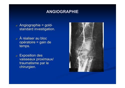 TRAUMATISMES OSTEO-VASCULAIRE DES MEMBRES