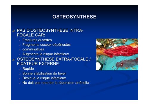 TRAUMATISMES OSTEO-VASCULAIRE DES MEMBRES