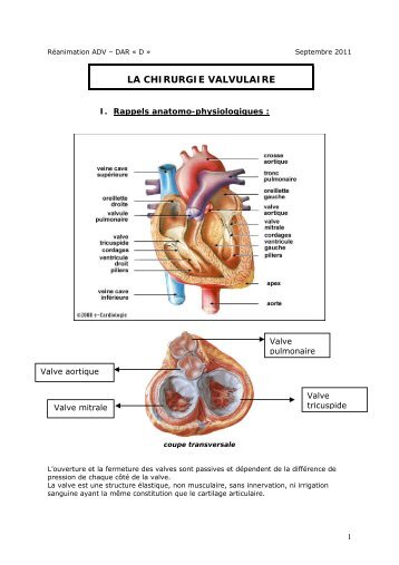 LA CHIRURGIE VALVULAIRE - CHU Montpellier