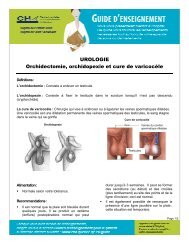 Orchidectomie, orchidopexie et cure de varicocèle VF