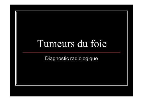 Tumeurs du foie interne - UBIR