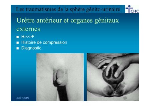 Les traumatismes de la sphère génito-urinaire - UCL Imaging