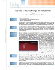 Les coils en neuroradiologie interventionnelle - Accident vasculaire ...