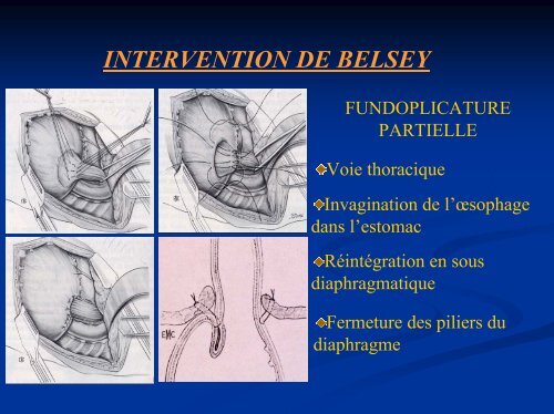 diaporama - chirurgie viscérale de l'ouest