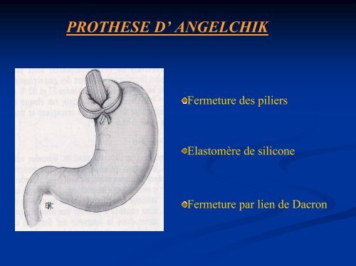 diaporama - chirurgie viscérale de l'ouest