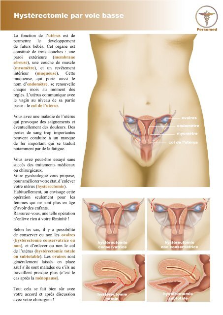 Hystérectomie par voie basse