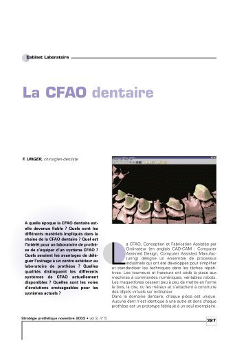 La CFAO dentaire - Information dentaire