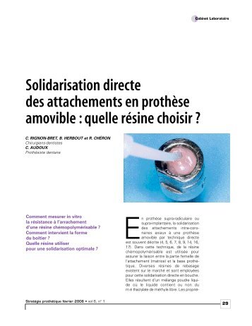 Solidarisation directe des attachements en prothèse amovible ...