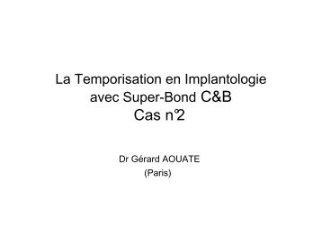 Dr Gérard AOUATE Cas clinique en Implantologie