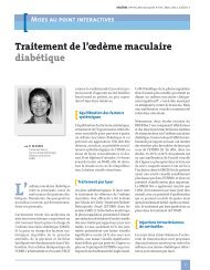 Traitement de l'œdème maculaire diabétique - Journées Interactives ...