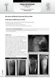 Une masse calcifiée des tissus mous chez un enfant - sotcot