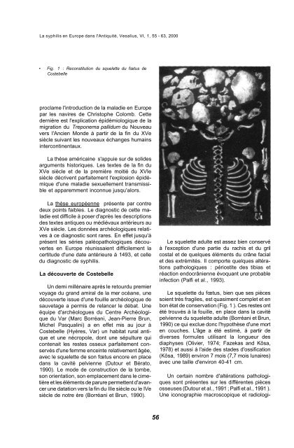 La syphilis en Europe dans l'Antiquité : le fœtus de Costebelle et les ...