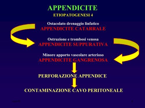 Appendicite