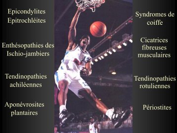 Diplôme universitaire de kinésithérapie du sport - Centre de ...