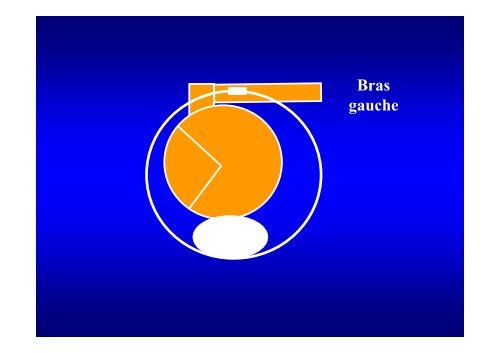 L'accouchement du siège pratique clinique