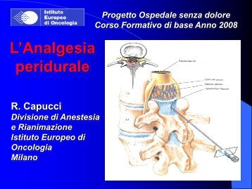 Analgesia peridurale - Istituto Europeo di Oncologia