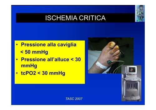 IL DOLORE ISCHEMICO - dolore cronico