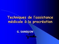 Techniques de l'assistance médicale à la procréation