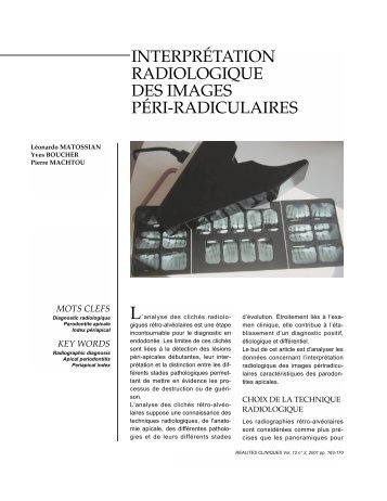 interprétation radiologique des images péri-radiculaires