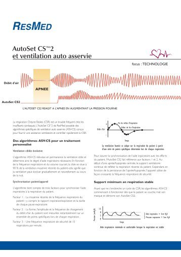 AutoSet CS™2 et ventilation auto asservie - ResMed