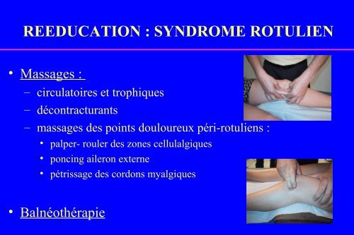 reeducation : syndrome rotulien