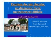 traitement du psoriasis du cuir chevelu - Psoriasis International ...