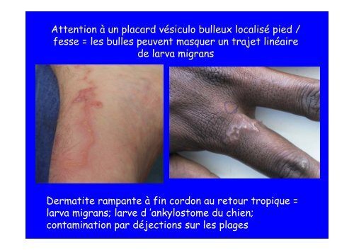 Le voyageur allergique Allergies chez le voyageur