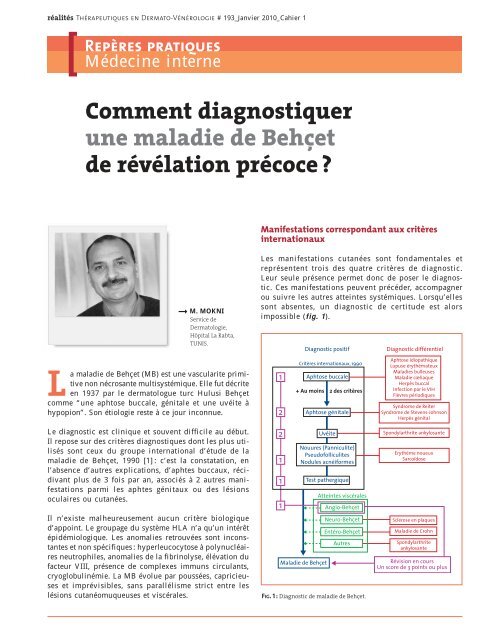 Comment diagnostiquer une maladie de Behçet de révélation précoce