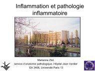 Processus Inflammatoire