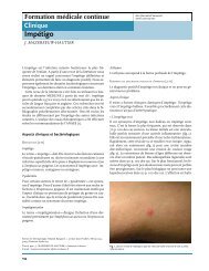 Impétigo - CEDEF, Collège des Enseignants en DErmatologie de ...