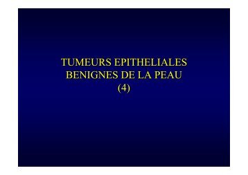 Tumeurs epitheliales benignes cutanees (4).pdf - AFIAP