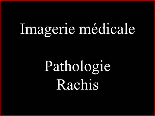 Pathologie du Rachis