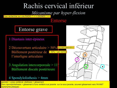 Pathologie du Rachis