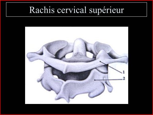 Pathologie du Rachis