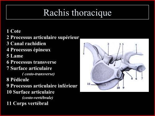 Pathologie du Rachis