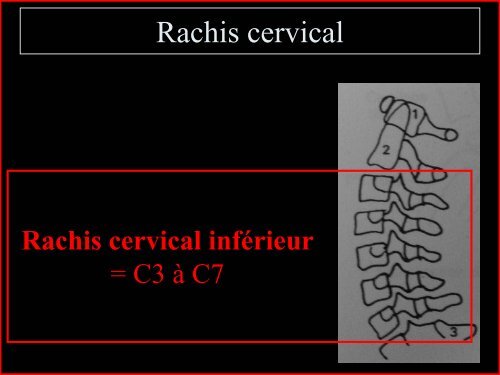 Pathologie du Rachis