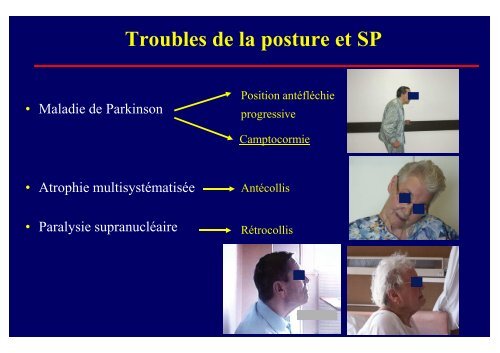 Troubles posturaux et syndromes parkinsoniens - Janv 2010