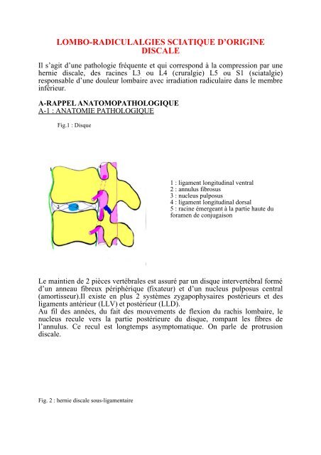 Trajetes sciatique l5 s1
