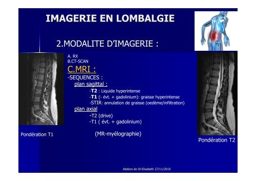 IMAGERIE EN LOMBALGIE - Europa Ziekenhuizen