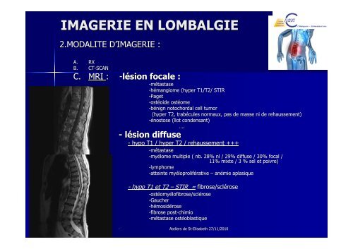 IMAGERIE EN LOMBALGIE - Europa Ziekenhuizen