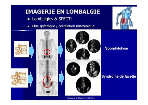 IMAGERIE EN LOMBALGIE - Europa Ziekenhuizen