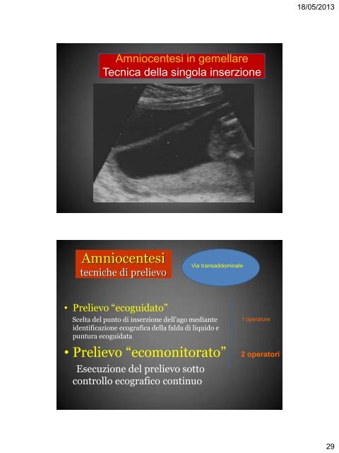 Diagnosi Prenatale Invasiva Problematiche - SIEOG