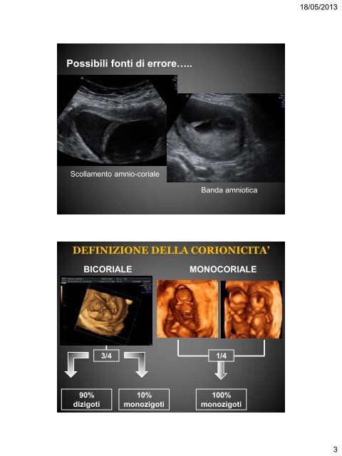 Diagnosi Prenatale Invasiva Problematiche - SIEOG