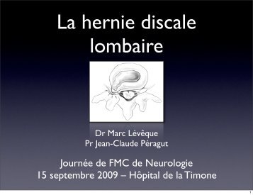 Journée de FMC de Neurologie 15 septembre 2009 – Hôpital de la ...