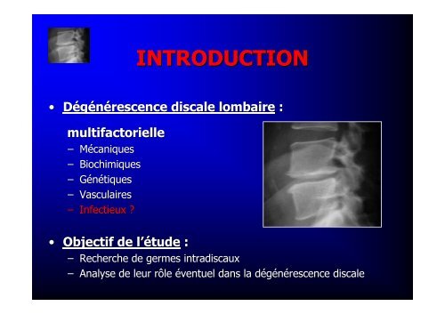 bacteriologie du disque intervertebral dans la discopathie ...