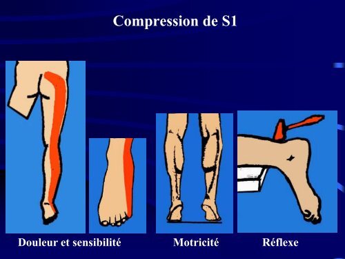 PATHOLOGIE RACHIDIENNE