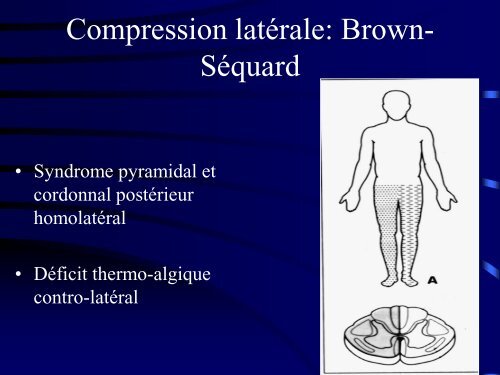 PATHOLOGIE RACHIDIENNE