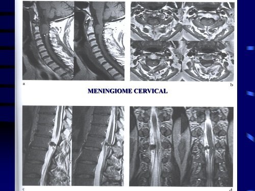 PATHOLOGIE RACHIDIENNE