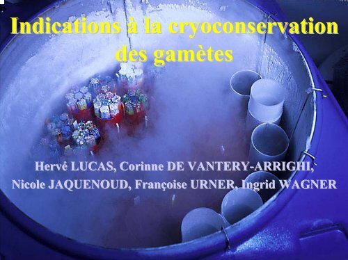 Indications à la cryoconservation des gamètes