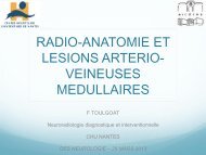 Radio-anatomie et lésions artério-veineuses médullaires